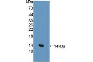 Figure. (SLC1A1 antibody  (AA 115-209))