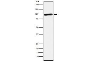 Western blot analysis of Calmegin expression in Jurkat cell lysate. (Recombinant Calmegin antibody)