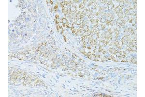Immunohistochemistry of paraffin-embedded mouse ovary using OCLN antibody.