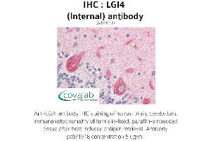 Image no. 1 for anti-Leucine-Rich Repeat LGI Family, Member 4 (LGI4) (Internal Region) antibody (ABIN1736431) (LGI4 antibody  (Internal Region))
