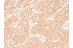 Formalin-fixed, paraffin-embedded human Adrenal stained with Adipophilin Mouse Monoclonal Antibody (ADFP/1366).
