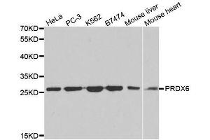 Western blot analysis of extracts of various cell lines, using PRDX6 antibody. (Peroxiredoxin 6 antibody  (AA 1-224))