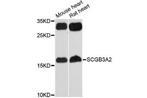 Western blot analysis of extracts of various cell lines, using SCGB3A2 antibody (ABIN6290951) at 1:3000 dilution. (SCGB3A2 antibody)