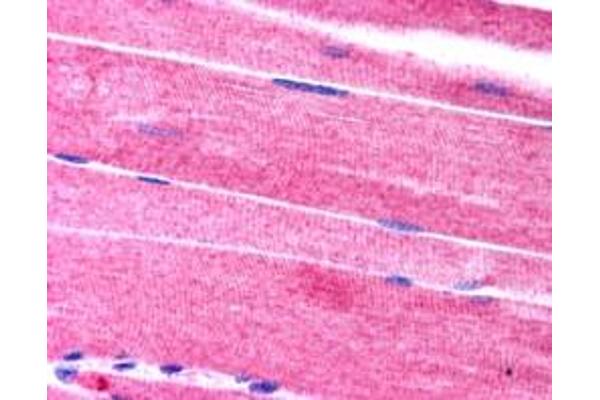 SORBS1 antibody  (C-Term)