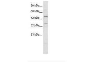 Image no. 1 for anti-Zinc Finger Protein 358 (ZNF358) (AA 104-153) antibody (ABIN202633) (ZNF358 antibody  (AA 104-153))