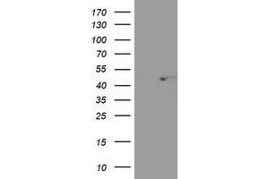 HEK293T cells were transfected with the pCMV6-ENTRY control (Left lane) or pCMV6-ENTRY SEC14L2 (Right lane) cDNA for 48 hrs and lysed. (SEC14L2 antibody)