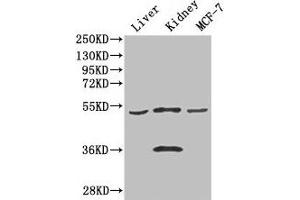 Western Blot Positive WB detected in: Mouse liver tissue, Mouse kidney tissue, MCF-7 whole cell lysate All lanes: CDSN antibody at 3 μg/mL Secondary Goat polyclonal to rabbit IgG at 1/50000 dilution Predicted band size: 52 kDa Observed band size: 52, 36 kDa (Corneodesmosin antibody  (AA 40-229))