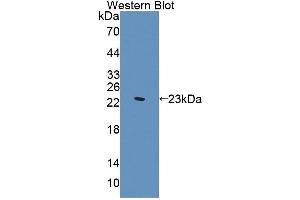 Detection of Recombinant SVIL, Human using Polyclonal Antibody to Supervillin (SVIL) (Supervillin antibody  (AA 1385-1525))