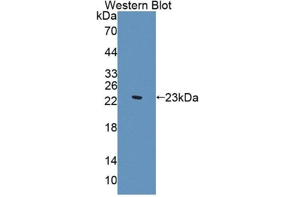 Supervillin antibody  (AA 1385-1525)