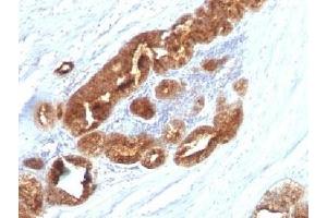 TAG-72 antibody