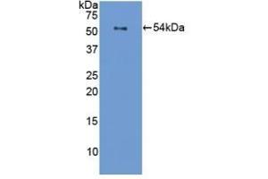 Detection of Recombinant FLG, Mouse using Polyclonal Antibody to Filaggrin (FLG) (Filaggrin antibody  (AA 119-336))