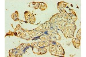 Immunohistochemistry of paraffin-embedded human placenta tissue using ABIN7145118 at dilution of 1:100 (ATG9B antibody  (AA 715-924))