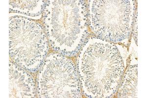 ABIN7094477 and ABIN7098525 at 1/100 staining Rat testis tissue by IHC-P. (DYNC1I1 antibody  (Internal Region))