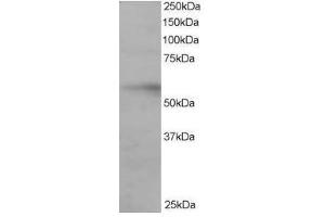 Image no. 1 for anti-Interferon Regulatory Factor 6 (IRF6) (C-Term) antibody (ABIN374199) (IRF6 antibody  (C-Term))