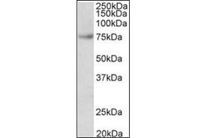FUBP1 Antibody Cat. (FUBP1 antibody  (Internal Region))