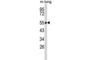 Western Blotting (WB) image for anti-Gc antibody (ABIN3003972) (Gc antibody)