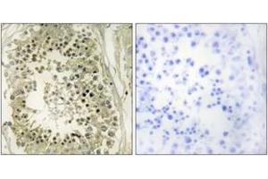 Immunohistochemistry analysis of paraffin-embedded human testis tissue, using HGS Antibody. (HGS antibody  (AA 451-500))