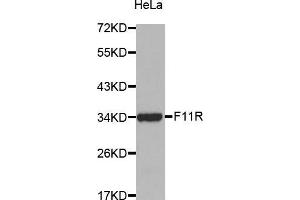 Western Blotting (WB) image for anti-F11 Receptor (F11R) (AA 30-238) antibody (ABIN3021823)