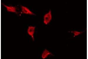 ABIN6266689 staining HuvEc by IF/ICC. (TP53I11 antibody  (N-Term))