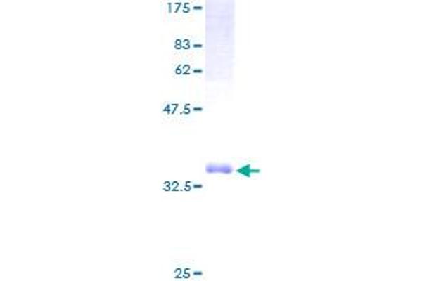 TCTA Protein (AA 1-103) (GST tag)
