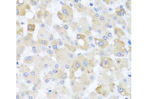 Immunohistochemistry of paraffin-embedded Human liver damage using CETN1 Polyclonal Antibody at dilution of 1:100 (40x lens). (Centrin 1 antibody)