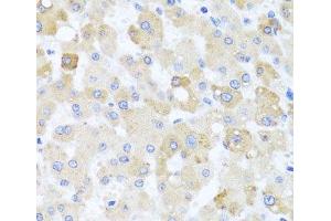 Immunohistochemistry of paraffin-embedded Human liver damage using CETN1 Polyclonal Antibody at dilution of 1:100 (40x lens).