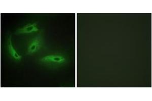 Immunofluorescence analysis of HeLa cells, using CDKL4 Antibody.