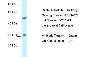 WB Suggested Anti-ITM2C Antibody   Titration: 1. (ITM2C antibody  (Middle Region))