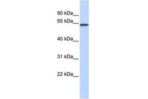 Image no. 1 for anti-anthrax Toxin Receptor 1 (ANTXR1) (AA 396-445) antibody (ABIN6743539) (ANTXR1 antibody  (AA 396-445))