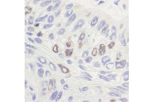 Immunohistochemistry (IHC) image for anti-Topo IIalpha (C-Term) antibody (ABIN7454588) (Topo IIalpha (C-Term) antibody)