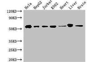 Western Blot Positive WB detected in: Hela whole cell lysate, HepG2 whole cell lysate, Jurkat whole cell lysate, K562 whole cell lysate, Mouse heart tissue, Mouse liver tissue, Mouse brain tissue All lanes: SMAD2 antibody at 3 μg/mL Secondary Goat polyclonal to rabbit IgG at 1/50000 dilution Predicted band size: 53, 49 kDa Observed band size: 53 kDa (SMAD2 antibody  (AA 2-467))