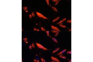 Immunofluorescence analysis of U-2 OS cells using LRRC7 antibody (ABIN6128203, ABIN6143347, ABIN6143348 and ABIN6216986) at dilution of 1:100. (LRRC7 antibody  (AA 730-890))