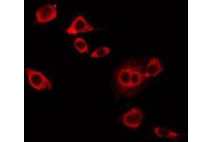 ABIN6276635 staining COLO205 by IF/ICC. (Syndecan 1 antibody  (C-Term))