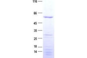 Validation with Western Blot (NUF2 Protein (His tag))