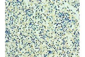 Immunohistochemistry of paraffin-embedded human spleen tissue using ABIN7166935 at dilution of 1:100 (RSPO1 antibody  (AA 21-263))