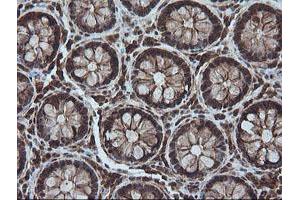 Image no. 1 for anti-Chaperonin Containing TCP1, Subunit 8 (Theta)-Like 2 (CCT8L2) antibody (ABIN1497480) (CCT8L2 antibody)