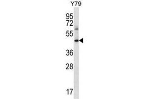 IFNGR1 Antibody (C-term) western blot analysis in Y79 cell line lysates (35µg/lane).