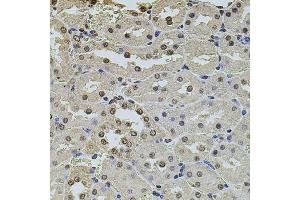 Immunohistochemistry of paraffin-embedded rat kidney using POT1 antibody. (POT1 antibody)