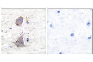 Immunohistochemical analysis of paraffin-embedded human brain tissue using GLUT1 antibody (ABIN5976416).
