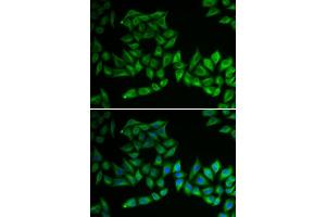Immunofluorescence analysis of U2OS cells using TPMT antibody . (TPMT antibody  (AA 1-245))