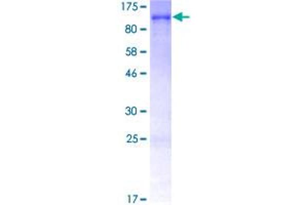 Lamin A/C Protein (LMNA) (AA 1-664) (GST tag)