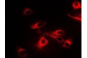 Immunofluorescent analysis of CCT2 staining in A549 cells. (CCT2 antibody)
