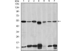 IRAK4 antibody