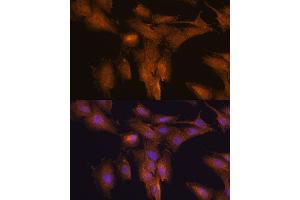 Immunofluorescence analysis of C6 cells using TSLP antibody (ABIN6128843, ABIN6149624, ABIN6149626 and ABIN6217014) at dilution of 1:100. (Thymic Stromal Lymphopoietin antibody  (AA 29-159))