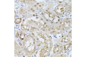 Immunohistochemistry of paraffin-embedded rat kidney using TPI1 antibody (ABIN7270977) at dilution of 1:100 (40x lens). (TPI1 antibody  (AA 1-249))