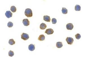 Immunocytochemistry of TLR9 in Jurkat cells with this product at 2 μg/ml. (TLR9 antibody  (Center))