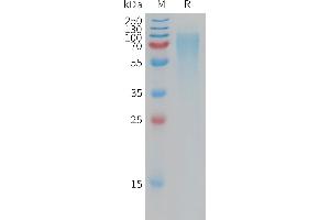 NPR2 Protein (AA 23-458) (His tag)