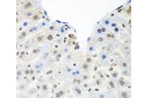 Immunohistochemistry of paraffin-embedded Mouse liver using TARDBP Polyclonal Antibody at dilution of 1:100 (40x lens). (TARDBP antibody)