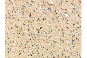 Phospho-IRF9 (Ser139) Antibody at 1/100 staining Rat heart tissue by IHC-P.