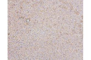 IHC analysis of HSPD1 using anti-HSPD1 antibody (ABIN7600976). (HSPD1 antibody  (AA 260-496))